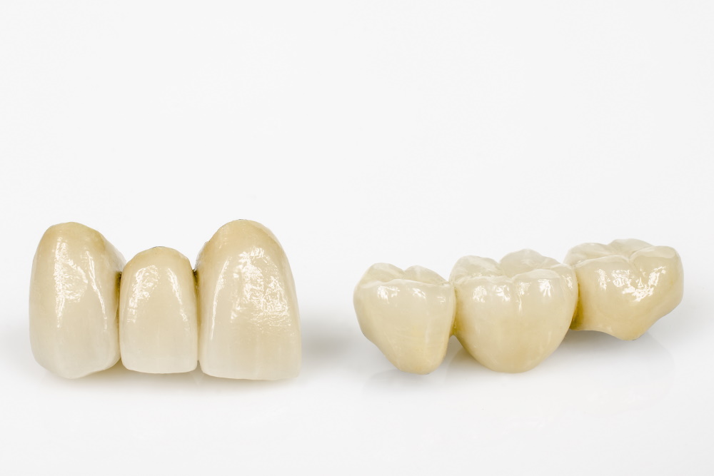Zahnsanierungen , Zahnarztpraxis Zahn und Biss, Dr. med. dent. Emilia Velea, 3063 Ittigen